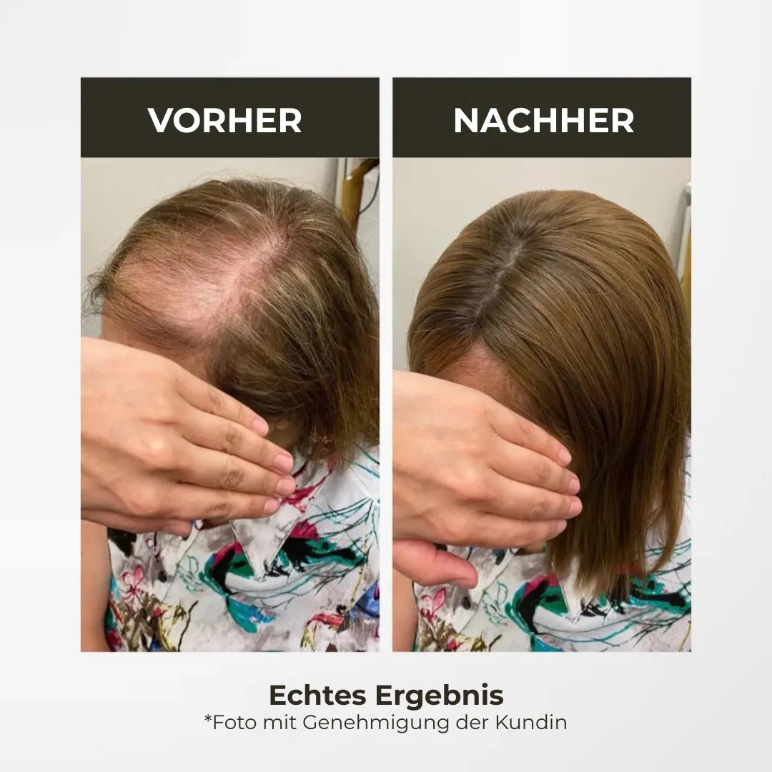 Top Closure – Natürlicher Haaransatz mit Pony 50 cm Welle | Für Haarausfall & lichte Stellen