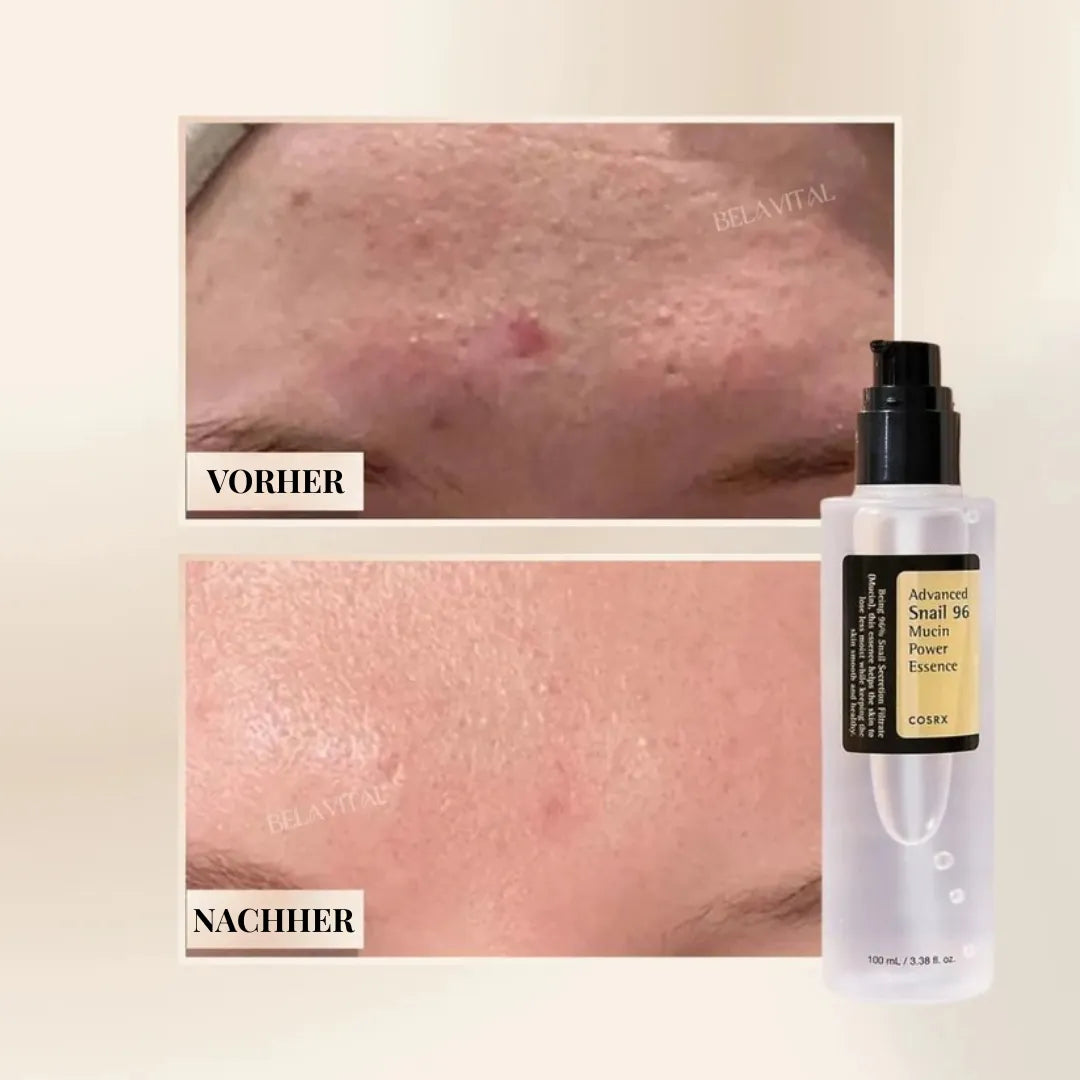 Advanced Snail 96 Serum | Koreanisches Hautpflege-Wunder mit 96 % Schneckenschleim