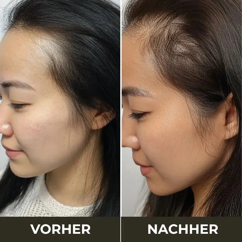 Anti-Haarausfall Kit: TheraBrush™ & Rosmarinöl