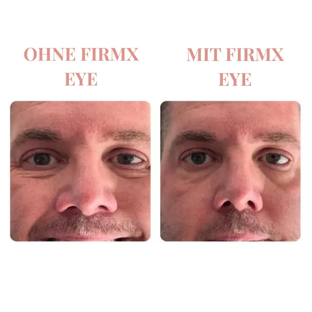 Instant FIRMX – Strahlend glatte Haut in 90 Sekunden