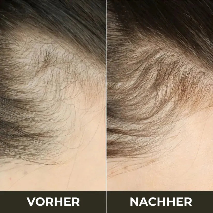 Premium-Haarpflege-Kit – Für kräftiges Haarwachstum & weniger Haarausfall